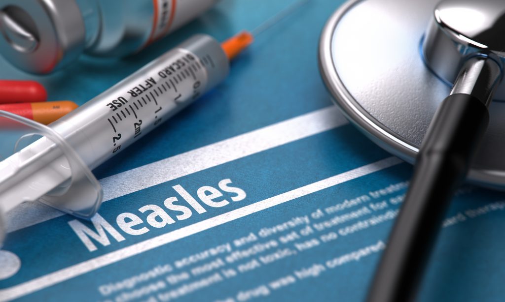 Measles not in Alabama yet