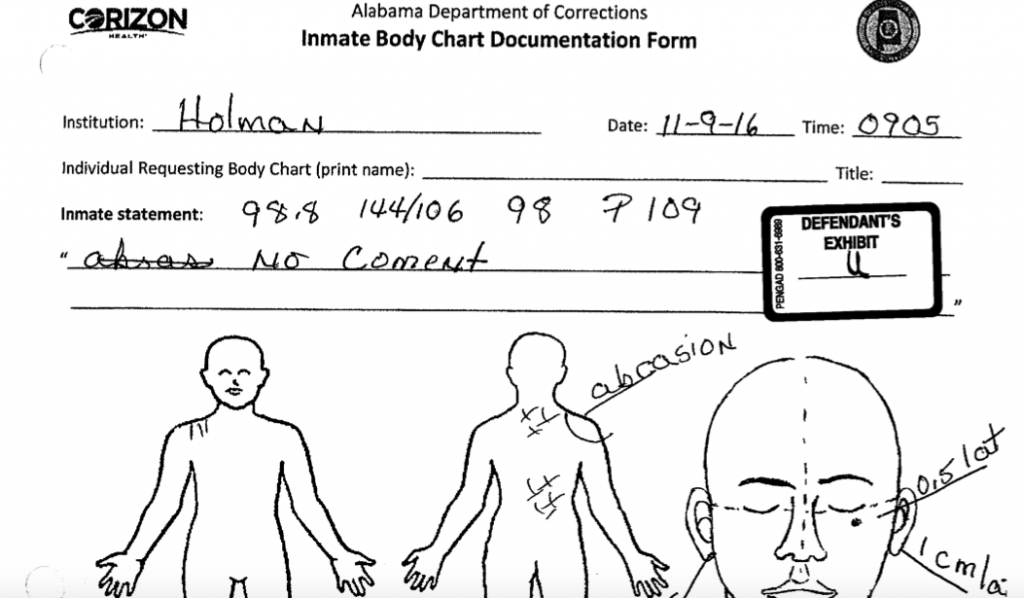 Lawsuits over 2016 raid at Holman prison allege guards beat handcuffed prisoners