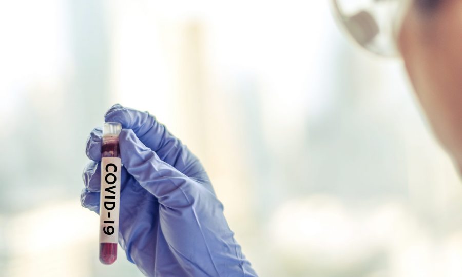 Brooks urges COVID-19 antibody tests