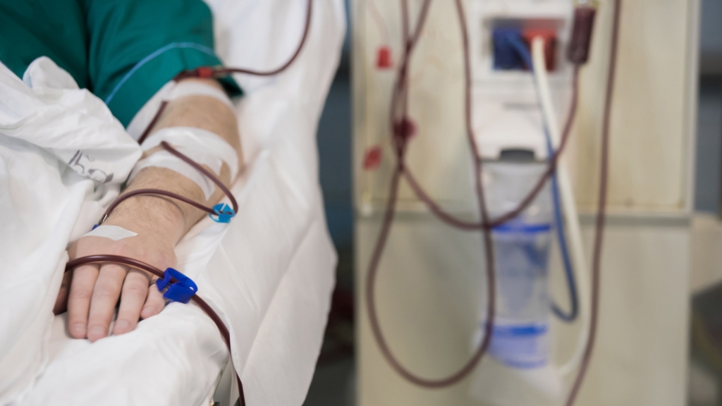 Opinion | The Supreme Court hurt Alabama’s dialysis community, and Congress must step in